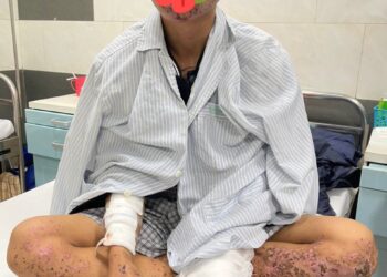 Cảnh báo: Cháy sém toàn thân, mất thị lực do dùng điện thoại khi đang sạc