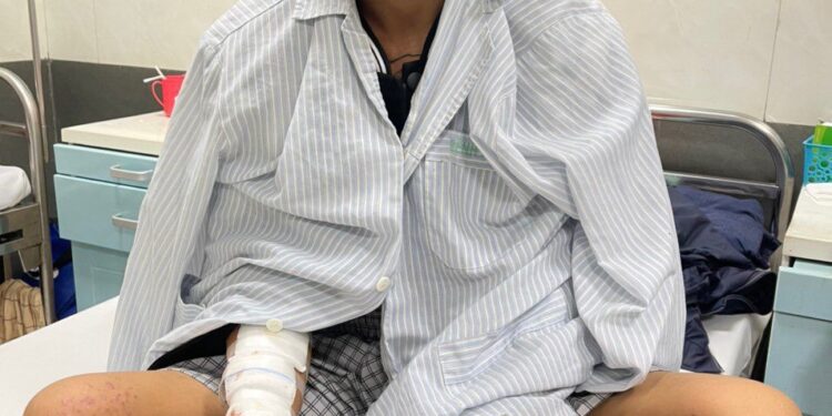 Cảnh báo: Cháy sém toàn thân, mất thị lực do dùng điện thoại khi đang sạc