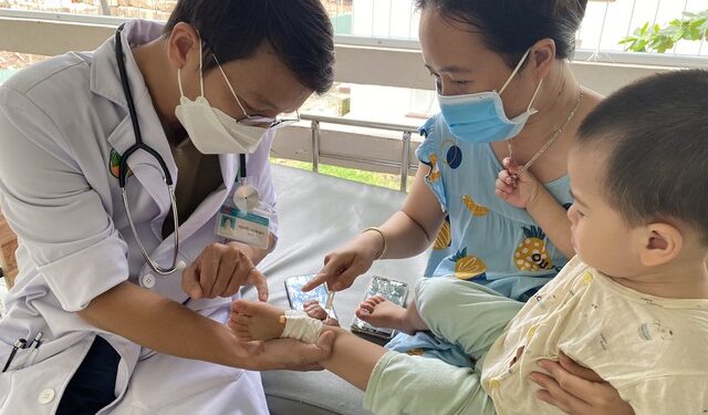 TP.HCM: Lo ngại bệnh tay chân miệng bùng phát trong thời gian tới