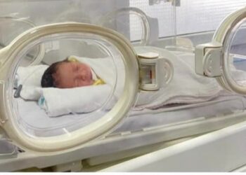 Cứu sống trẻ sinh non mắc nhiều bệnh lý phức tạp, suy hô hấp, nhiễm khuẩn đa kháng