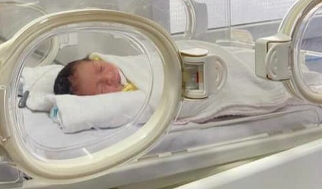 Cứu sống trẻ sinh non mắc nhiều bệnh lý phức tạp, suy hô hấp, nhiễm khuẩn đa kháng