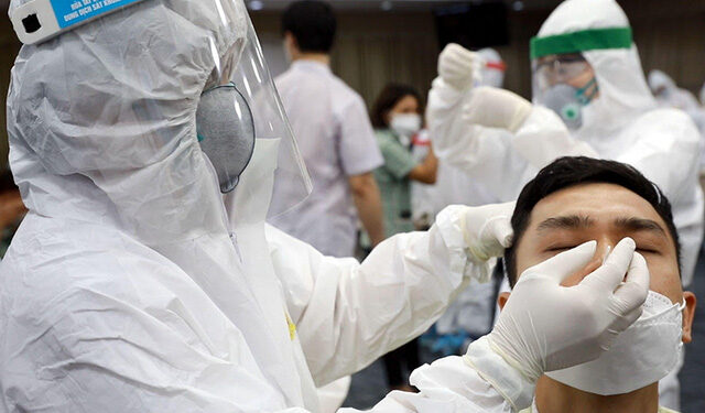 Tăng cường thanh kiểm tra, giám sát giá dịch vụ chẩn đoán nhanh và xét nghiệm PCR