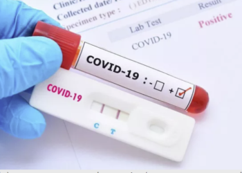 Bộ Y tế: Các địa phương lập đoàn kiểm tra việc kinh doanh test kit xét nghiệm nhanh và PCR