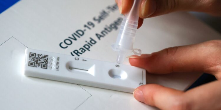 Bộ Y tế: Cơ sở kinh doanh phải niêm yết giá bán test xét nghiệm COVID-19; Xử lý nghiêm việc ‘thổi’ giá