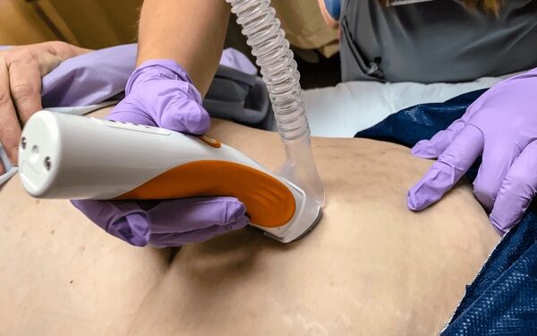 Chuẩn bị da trước phẫu thuật thoát vị : tông đơ hay dao cạo tốt hơn ?